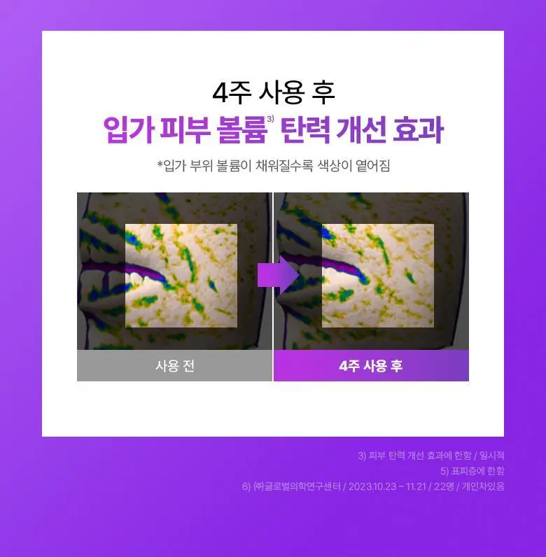 [기프트세트] 바이오힐보 프로바이오덤 3D 리프팅 스킨케어 3종 기획 (토너+에멀전+3D 리프팅 크림) 상세페이지 19